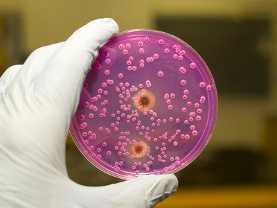 Eisenbakterien Wassertest sulfatreduzierende und schleimbildende Bakterien